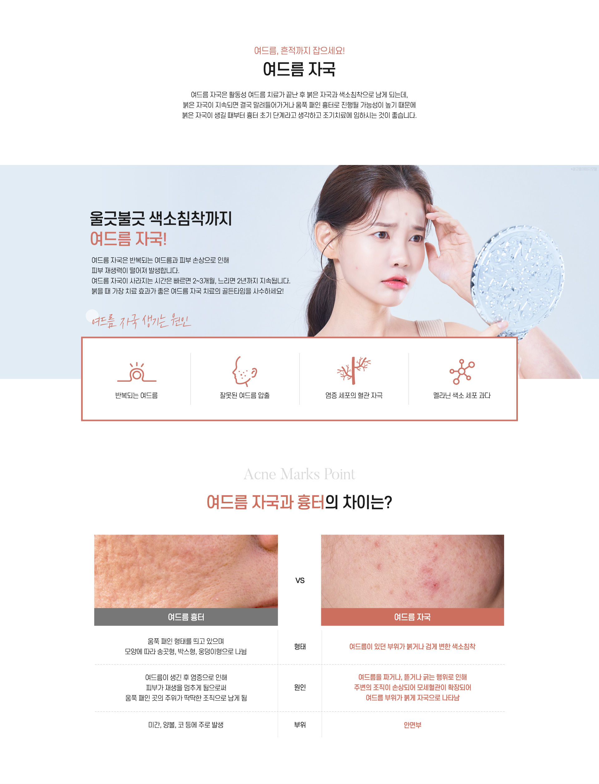 울긋불긋 색소침착까지 여드름 자국!